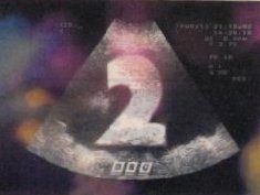 Birth Night Scan Ident